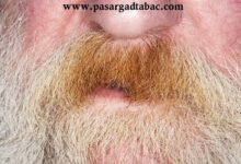 چگونه زردی سبیل را از بین ببریم – ۱۰ نکته مهم در رفع زردی سبیل بر اثر سیگار