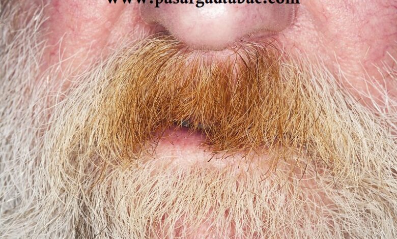 چگونه زردی سبیل را از بین ببریم – ۱۰ نکته مهم در رفع زردی سبیل بر اثر سیگار